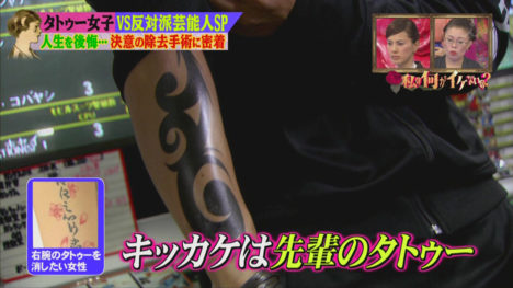 japanese-tattoo-removal-comparison-027