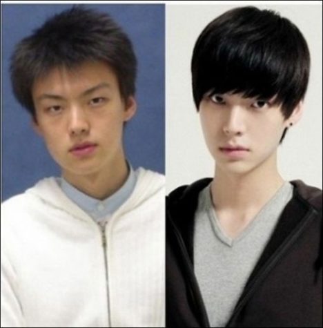 korean-plastic-surgery-before-and-after-25