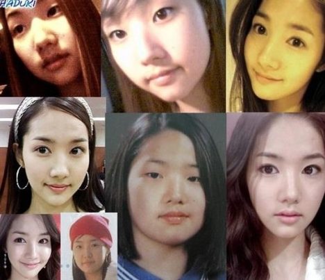 korean-plastic-surgery-before-and-after-comparison