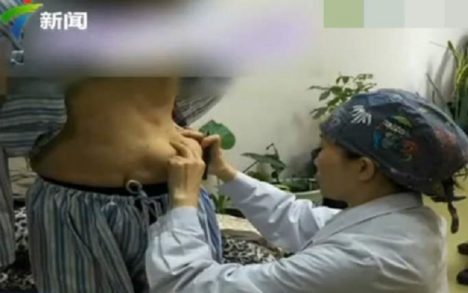Chinese-Woman-Implants-Stomach-1